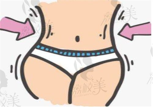成都華生鉑悅王欣做吸脂馬甲線塑形價(jià)格18800元起，專利技術(shù)腰圍立減8cm+