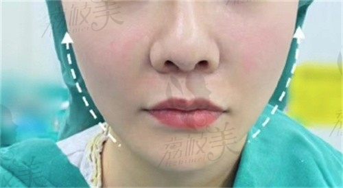 手术后