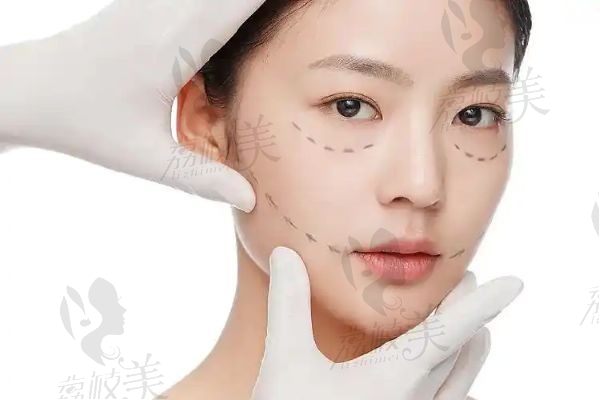 項昌峰做的鼻子風格是自然型的，兼具多樣化鼻型設(shè)計能力