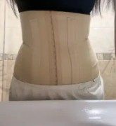 手术后