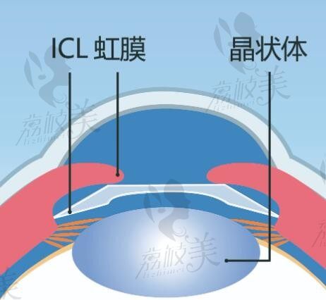 寧波愛爾眼科醫(yī)院近視眼手術(shù)收費(fèi)標(biāo)準(zhǔn)+醫(yī)生名單公開（附地址電話）