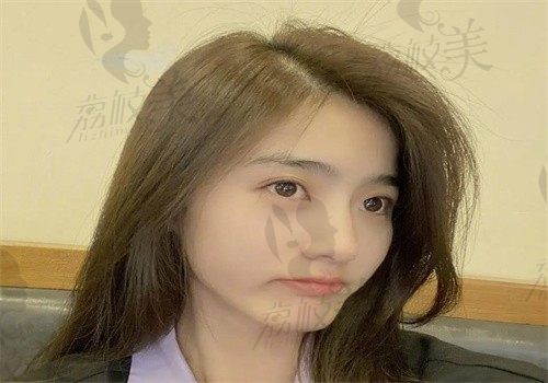手术后