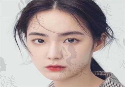 我的鼻综合改造记：上海美莱黄惠真医生隆鼻技术+术后半年效果追踪