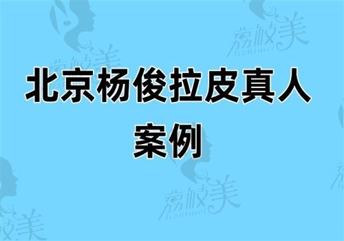 北京杨俊拉皮真人案例：我52岁术后7天，法令纹就消失像换了张脸！