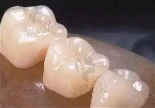 杭州薇琳口腔医院口碑怎么样？从案例到收费全面解析，避坑必看指南