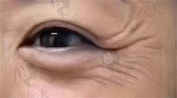 手术前