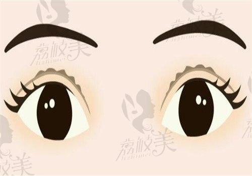 吕方中挂号费3980元值吗？患者亲述双眼皮修复面诊全流程体验！