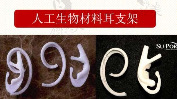 全国耳再造医生医院排名榜前十速看！2025 权威榜单 + 手术费用对比