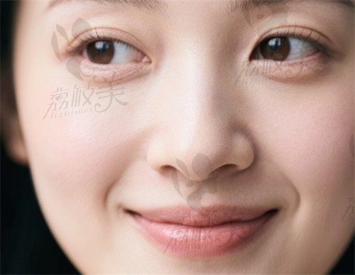 广州崔东做鼻修复实录:硅胶取出+肋软骨皮质软骨重建,术后自然度达99%