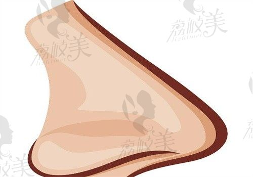 杭州艺星张龙做肋软骨皮质软骨隆鼻价格4万起，支撑度高结果好