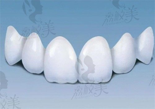 青岛可恩口腔医院冯子哲做E-max瓷贴面4颗价格5994元起，打造微笑美学
