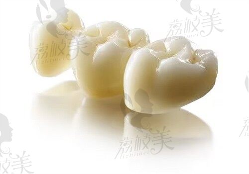 攀枝花明皓口腔周虎跃做拉瓦全瓷牙价格是7700元起，稳固性高不脱落