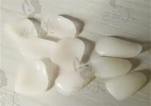 洛阳维乐口腔医院能刷医保吗？可以刷且收费不贵有5家分院地址在文中