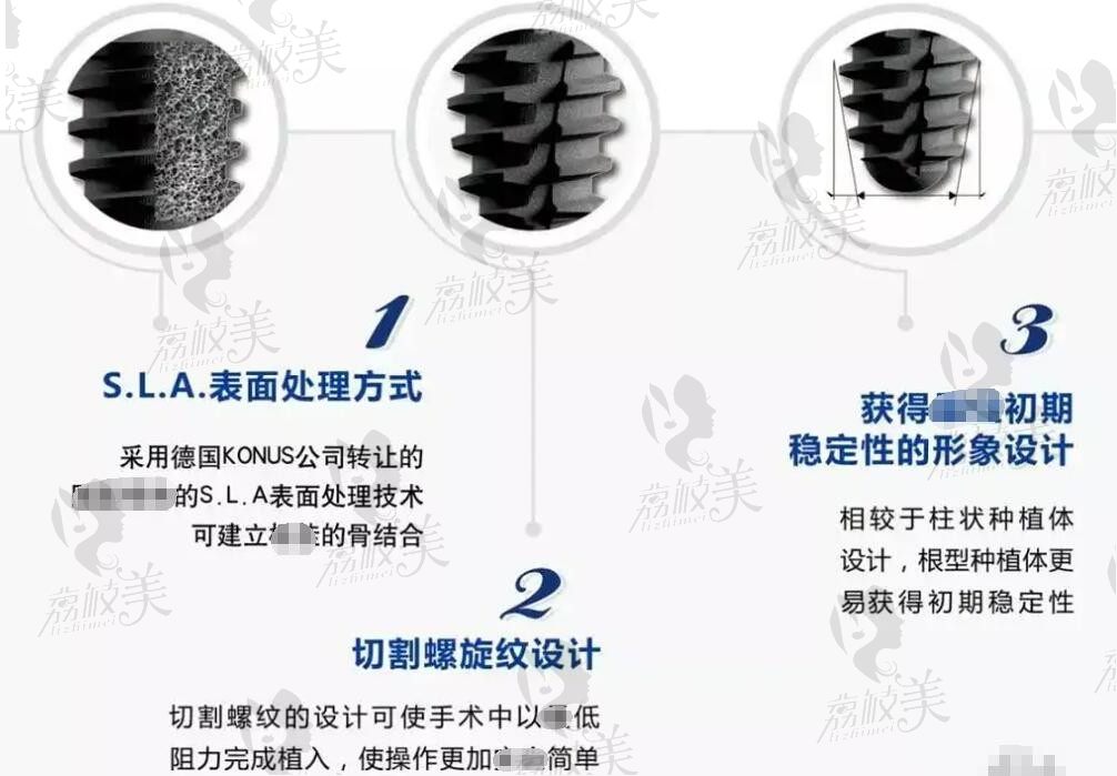 杭州拱墅口腔医院整牙种牙费用5000+，二级专科院长看牙质量没话说