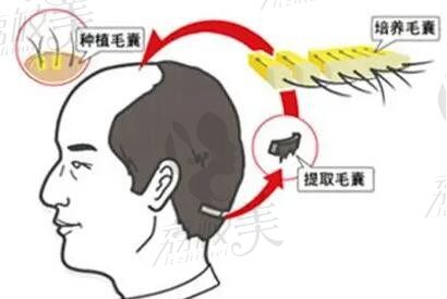合肥青穗植发医院地址\电话全公开！到院路线 + 预约方式一站式整理