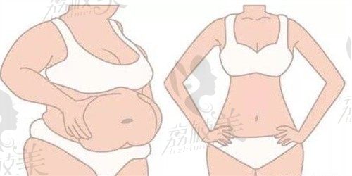 成都新丽美陈再洪做腹壁成形价格25000~50000不等,有效疤痕管理评价好