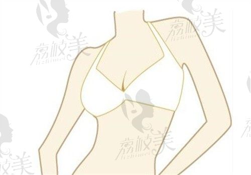 韦元强脂肪移植案例：术后3年吸收率＜20%的跟踪研究