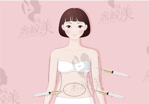 北京禾美嘉贺天遥做魔V面部钻石精雕价格49000~66000元起，脂肪填充成活率高