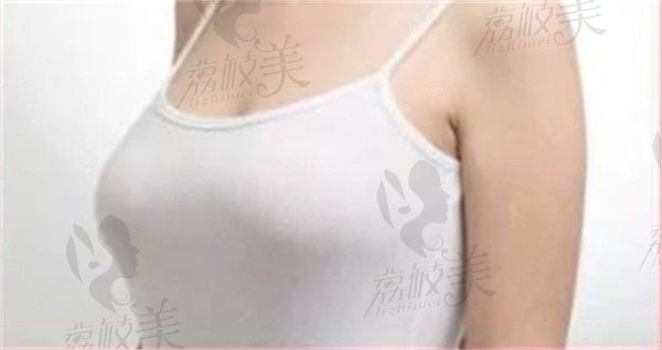 手术后