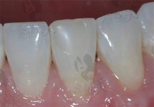 上海奉賢口腔醫(yī)院哪家好?分享上海奉賢看牙口碑好又正規(guī)的10家牙科名單
