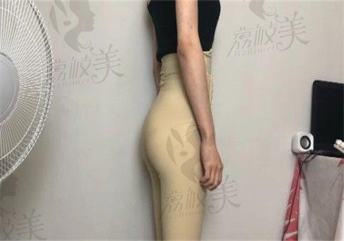 手术后