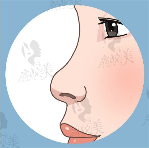 王旭明醫(yī)生鼻子做的好嗎?整友反饋王旭明擅長鼻綜合&鼻修復(fù),參考案例多