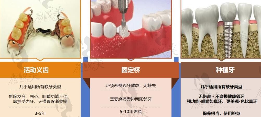 厦门拜瑞口腔医院种植牙一颗1680元信息可靠吗？揭晓2025价格表及植体来源真相！