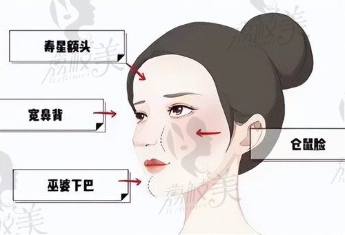 成都美蒂菲整形田浩祥做馒化脸修复价格4万起,韩籍医生口碑好