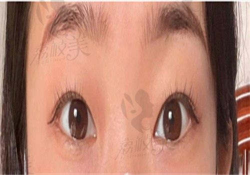 手术前