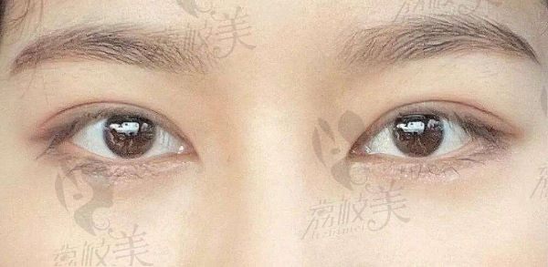 南昌割眼袋哪个医院好？盘点南昌正规技术好费用划算的医美医院