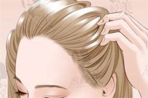 章光101和章光瑞丝有什么区别哪种好?瑞丝系列”纳米渗透技术”,防脱效率提升30%