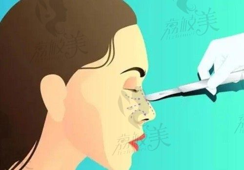 上海联合丽格范荣杰初鼻半肋综合5W多，5大技术让风格自然精致