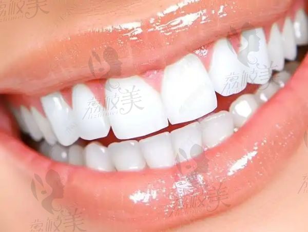 淄博可恩口腔醫(yī)院靠譜嗎？口碑認證的正規(guī)機構，服務貼心技術強