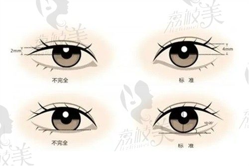 郝立君的私人诊所地址在哪里?找郝立君做双眼皮修复的朋友抢号技巧快码住!