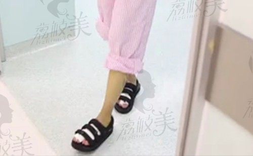 苏敬达大脚骨手术费用是1-3w元，微孔治疗拇外翻不影响走路运动