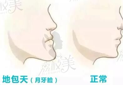 北京丰联丽菁口腔口碑怎么样？正畸患者匿名爆料挂号徐宝华比较难但复诊免排队