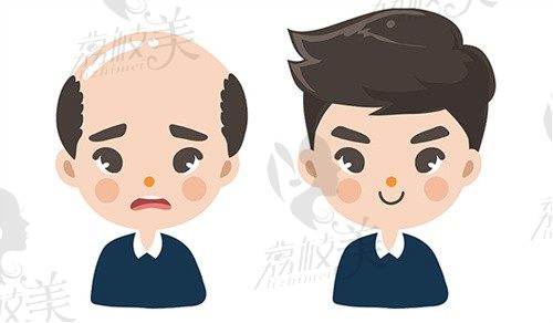 Hbw毛囊克隆可靠吗?最新消息国内已临床上市,北上广深首批10家医院名单曝光!