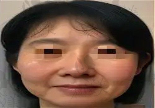 手术前