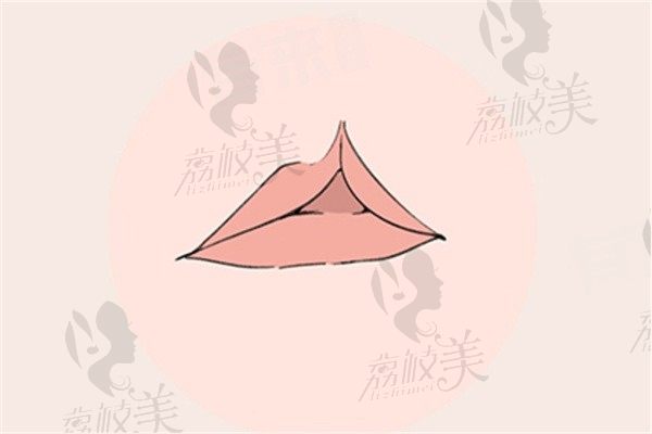 唇裂二次修复哪个医院好？推荐6家北上广深及成都重庆唇裂修复医院