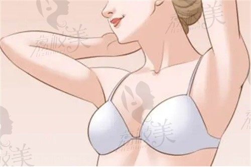 深圳源美朱志祥做微创剔除乳腺结节手术59800-188000不得,可有效预防乳腺癌