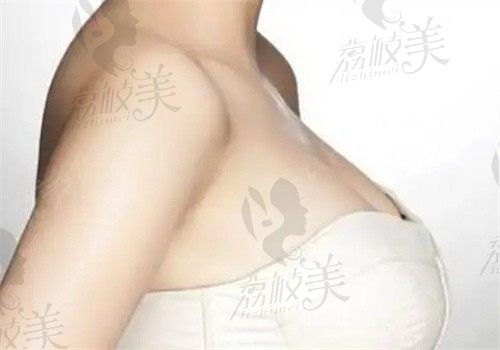 手术后