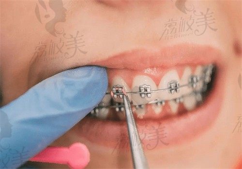 焦作中浩口腔医院是正规医院吗？是正规牙科顾客评价说看牙亲民又靠谱