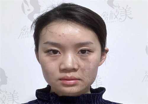 手术前