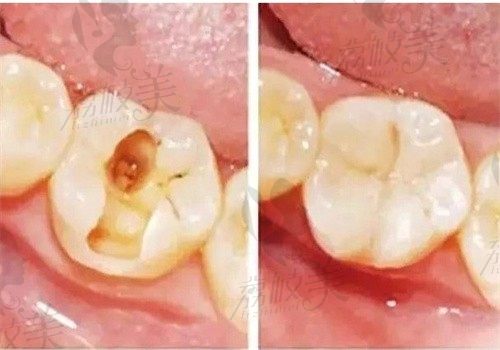 乐山启辰口腔医院是正规的吗？资质齐全很正规而且看牙价格不贵性价比高