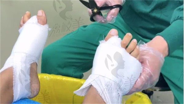手术后