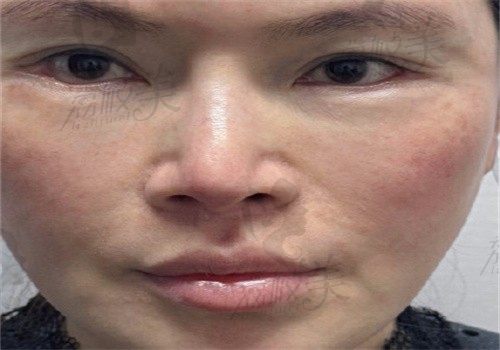 手术前