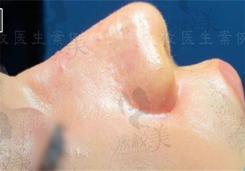 手术前