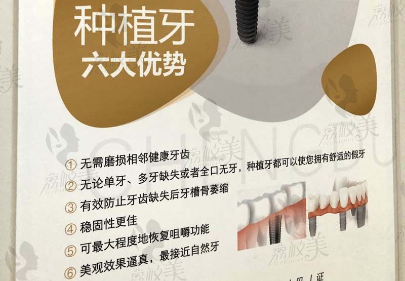 成都博爱口腔种牙优势