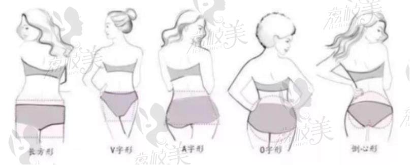 荔枝美：北京禾美嘉医疗美容医院任学会院长的自体脂肪丰臀文章中的臀型照片