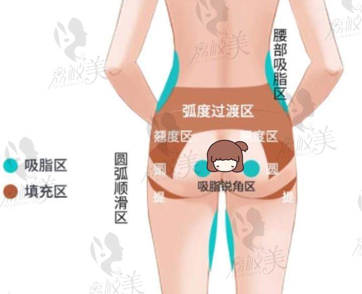荔枝美：北京禾美嘉医疗美容医院任学会院长的自体脂肪的丰臀图